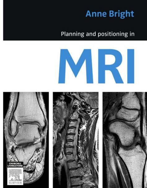 planning and positioning in mri PDF