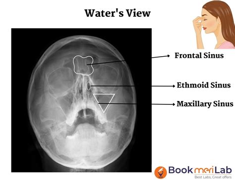 pns x ray