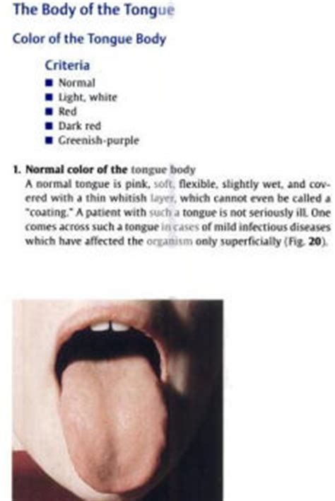 pocket atlas of tongue diagnosis pocket atlas of tongue diagnosis Epub