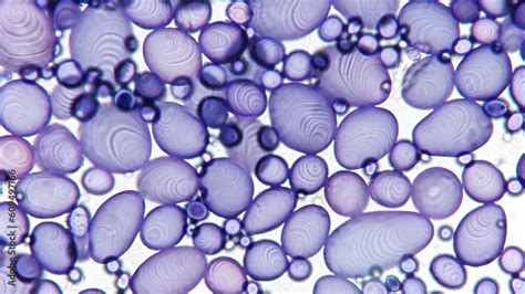potato under microscope