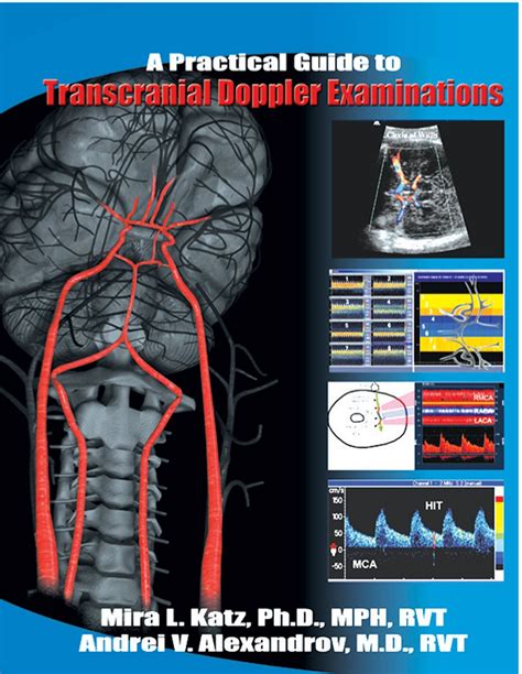 practical guide to transcranial doppler examinations PDF