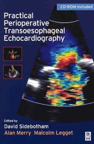 practical perioperative transoesophageal echocardiography text with cd rom 1e Doc