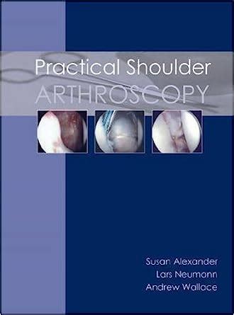 practical shoulder arthroscopy susan alexander PDF