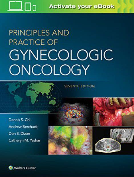 principles and practice of gynecologic oncology Kindle Editon