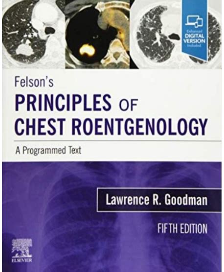 principles of chest roentgenology a programmed text Kindle Editon