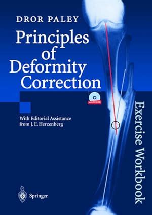 principles of deformity correction Ebook PDF