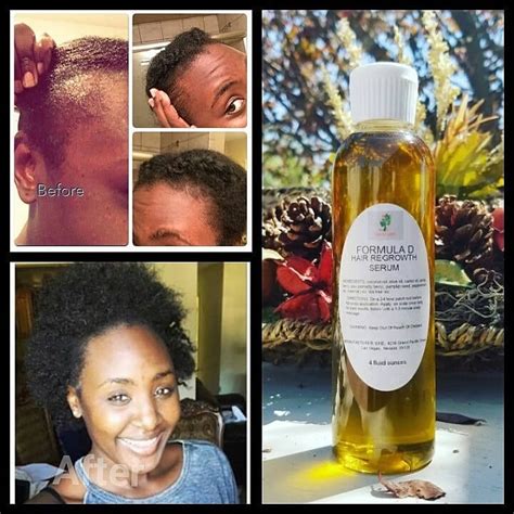 private label natural hair care skin care products manufacturers Kindle Editon