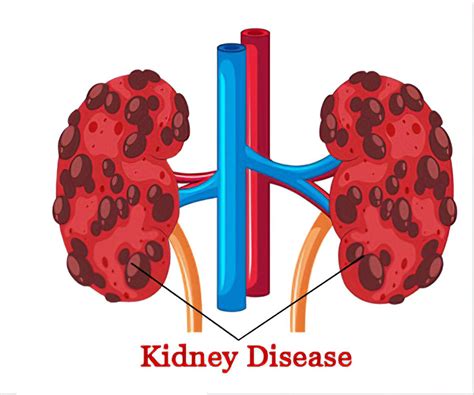 problems of kidney disease