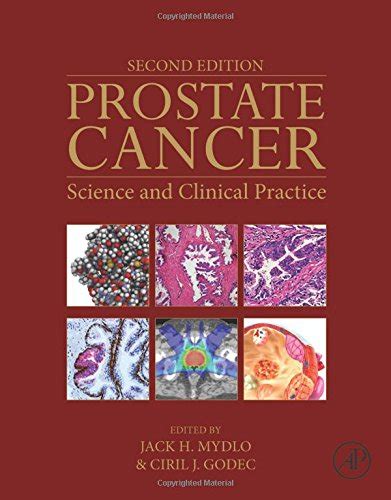 prostate cancer second edition science and clinical practice Epub