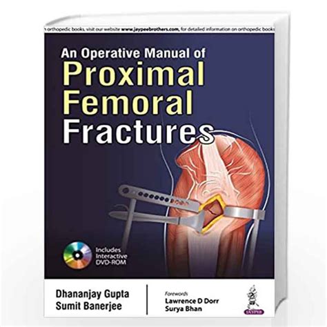 proximal femoral fractures operative manual Epub