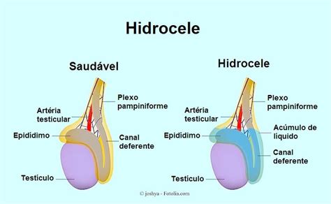 prurido escrotal