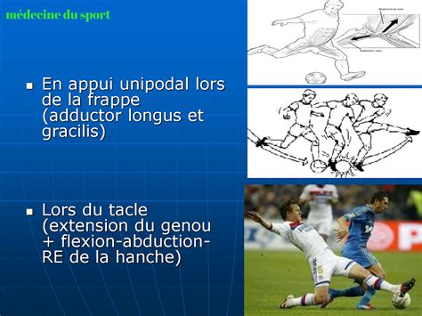 pubalgie-du-sportif-ppt Ebook PDF