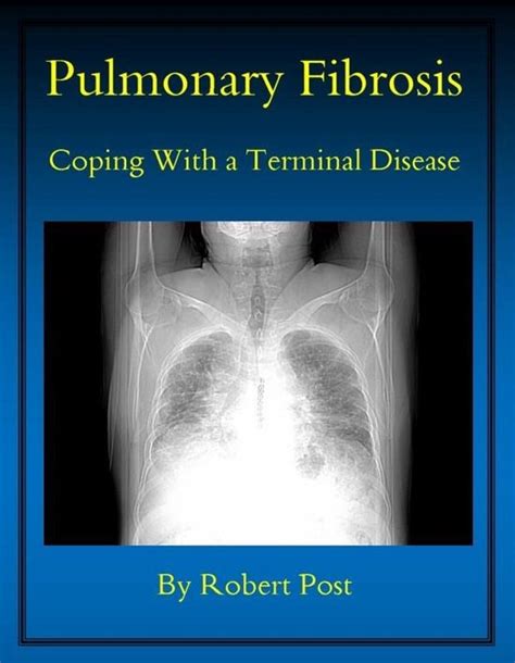 pulmonary fibrosis coping with a terminal disease Epub