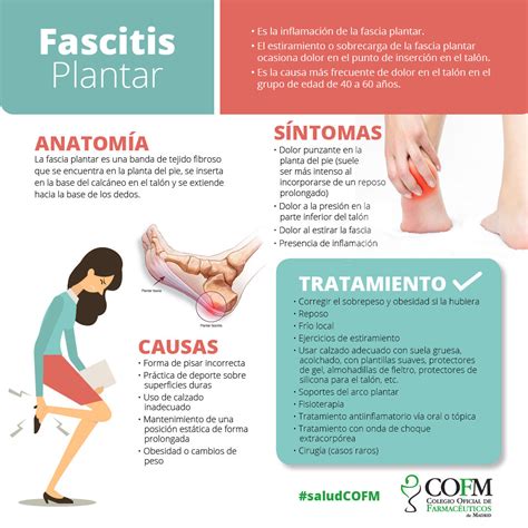 que es fascitis plantar