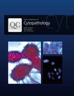 quick compendium of cytopathology ascp quick compendium Epub