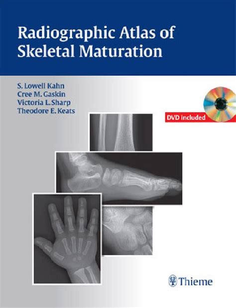 radiographic atlas of skeletal maturation Reader