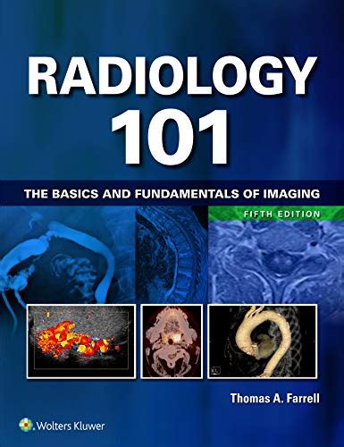 radiology 101 the basics and fundamentals of imaging PDF