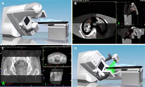 radiotherapy in practice imaging radiotherapy in practice imaging Reader