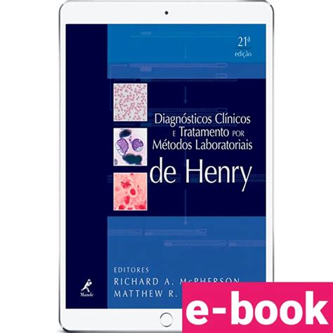 read unlimited books online henry jb diagnosticos clinicose e tratamentos por mtodos laboratoriais pdf book Epub