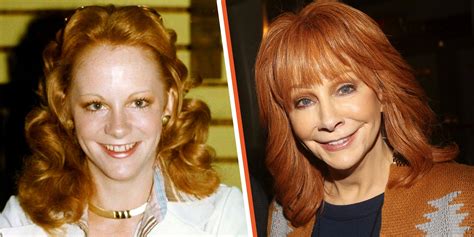 reba mcentire face surgery