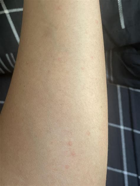 red bumps on skin not itchy