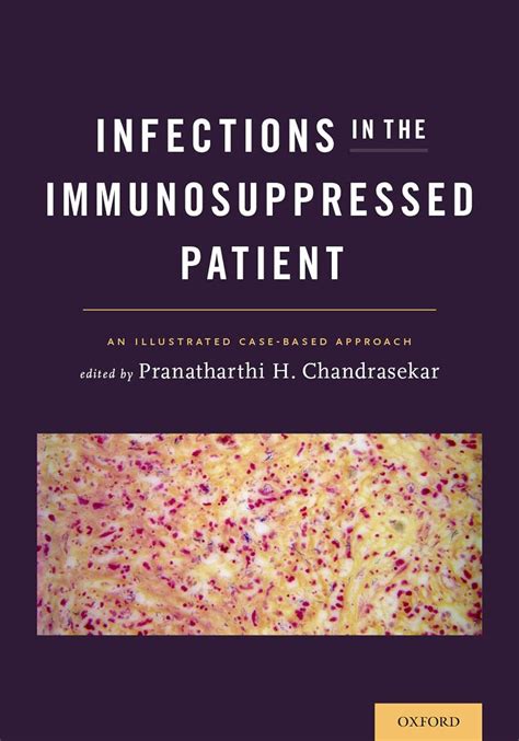 register infections immunosuppressed patient illustrated case based Kindle Editon