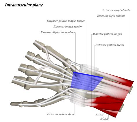 release extensor carpi ulnaris cpt code Doc