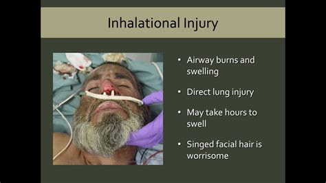 respiratory injury smoke inhalation and burns Doc