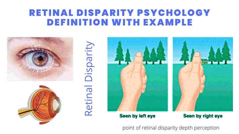 retinal disparity example