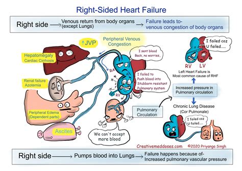 right sided congestive heart failure