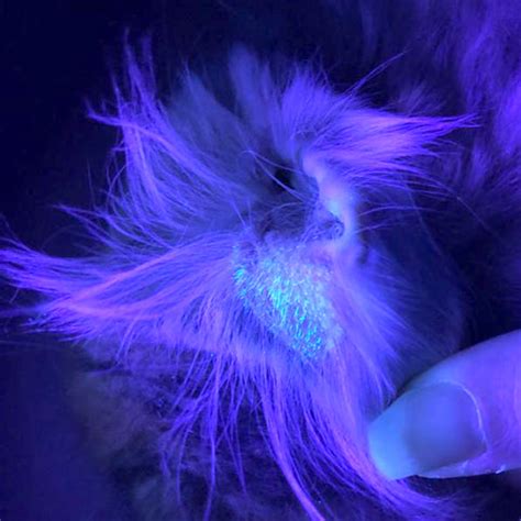 ringworm under black light