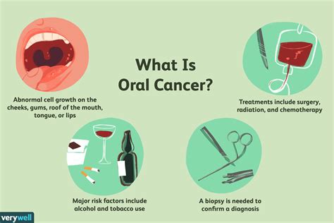 roof of mouth cancer