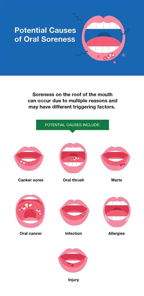 roof of mouth hurts