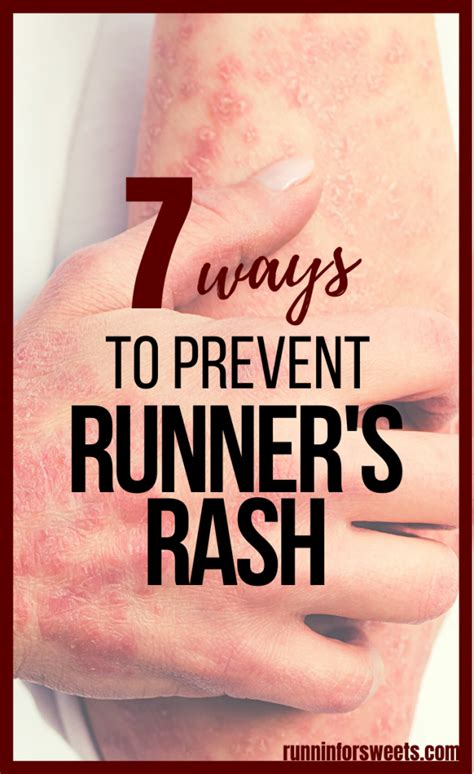 runners rash