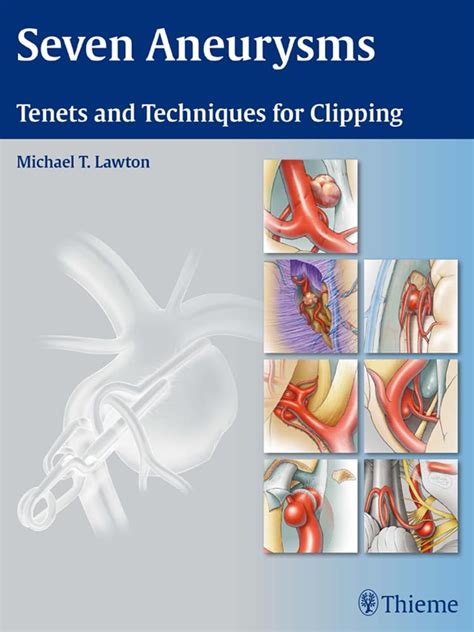 seven aneurysms tenets and techniques for clipping Doc
