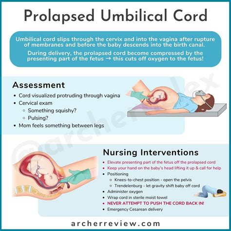severe prolapse manual guide Epub