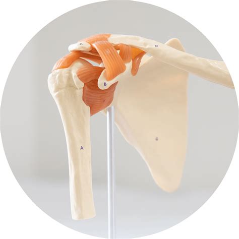 shoulder reconstruction Epub