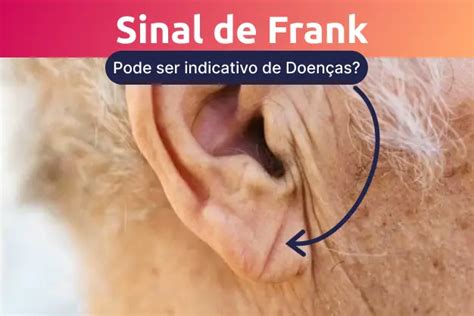 sinal de frank orelha