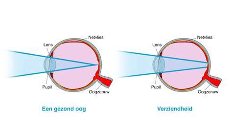 sluit toch ns een oog Doc