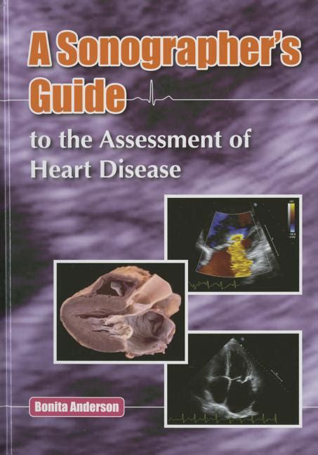 sonographers guide to the assessment of heart disease Epub