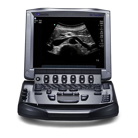 sonosite m turbo user manual Doc