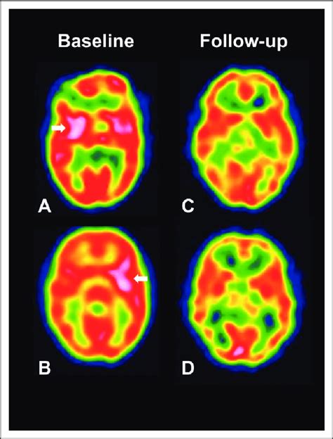 spect imaging of the brain spect imaging of the brain Epub