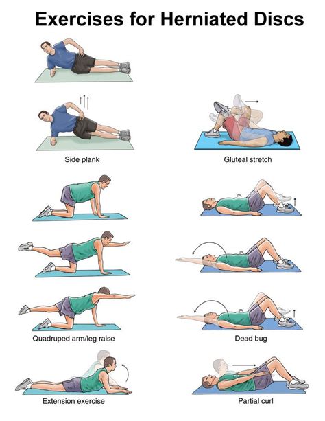 spinal disc herniation exercises