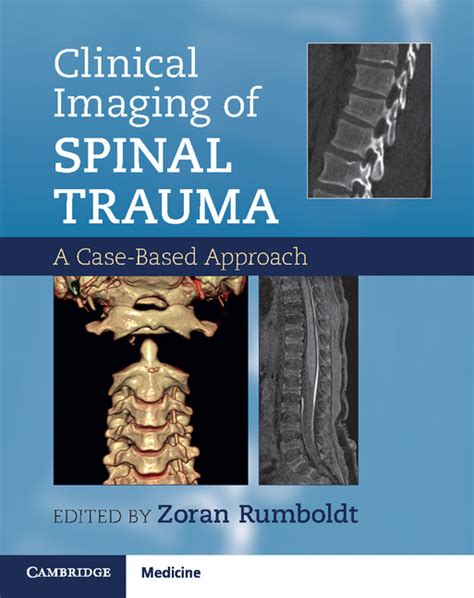 spinal trauma imaging diagnosis and management Kindle Editon