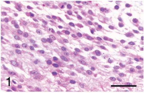 spindle cell tumor dog