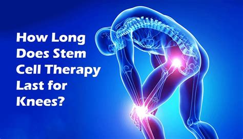 stem cell for knees