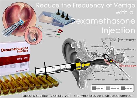 steroids for ear infection