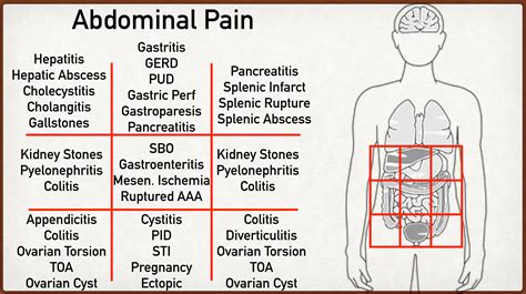 Stomach Pain Location Chart