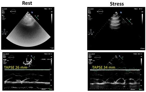 stress echocardiography PDF