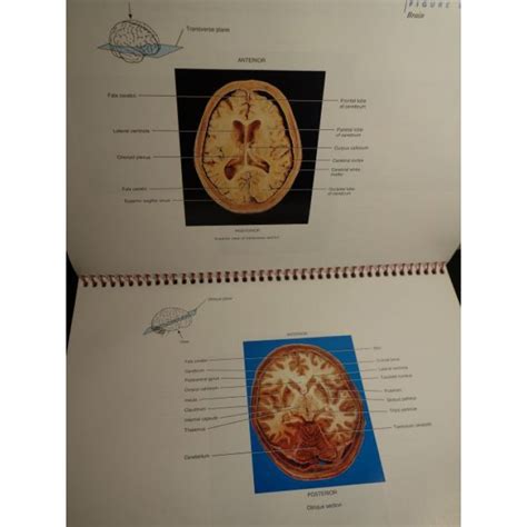 structure of the human brain a photographic atlas Reader